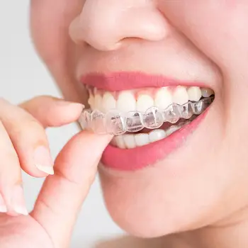 Silikoninės dantų apsaugos breketų rinkinys Burnos apsaugos dantų balinimo dėklas (2vnt)